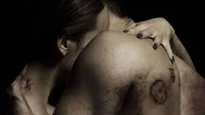 Căn Bệnh Quái Ác 2 Tập Full